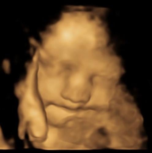 Toddlers can remember vegetable smells from the womb, reveals study