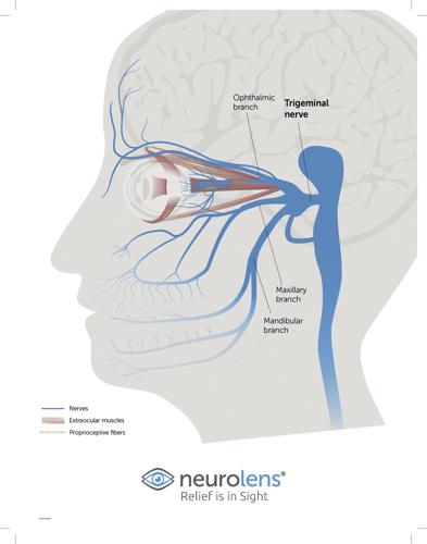 Trigeminal-Nerve-Graphic.jpg