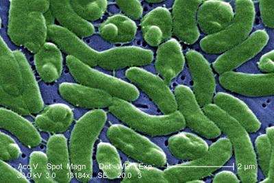 _Vibrio vulnificus_ infections are spreading across the U.S. because of climate change CDC/Colorized by James Gathany