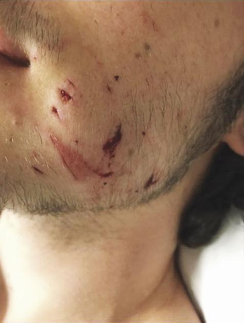 Maine Wardens investigate bobcat attacks in western Maine