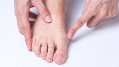 Got bunions? Here are 6 things you should know