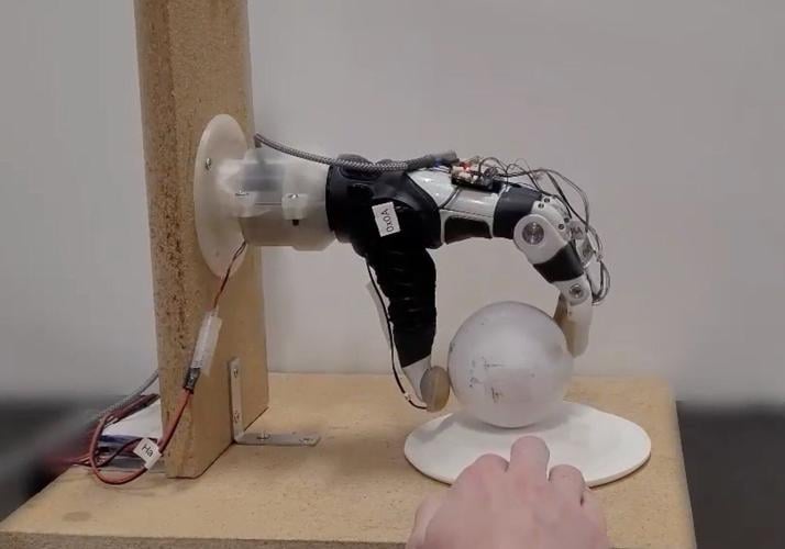 Bionic hand given AI “mind of its own” to make life easier for amputees
