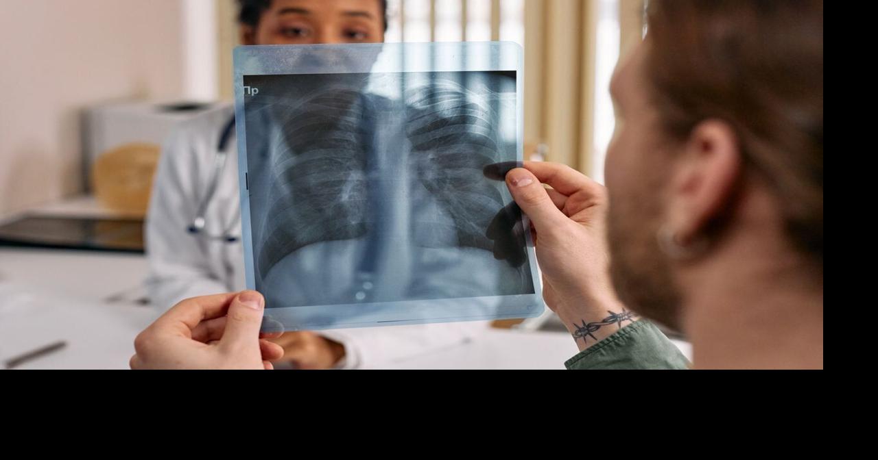 Targeting ‘immune fog’ may help stop lung cancer before it starts ...