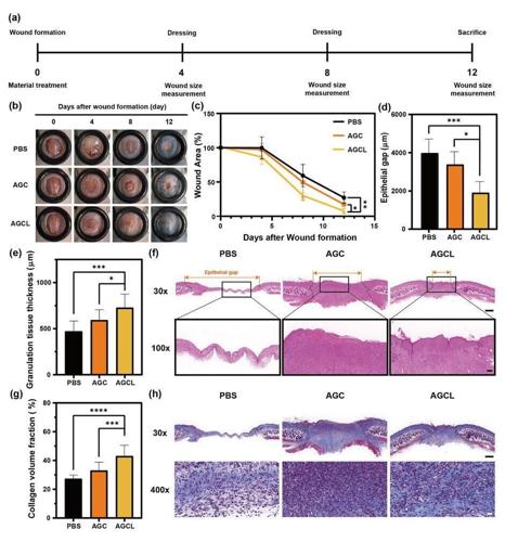 New spray-on powder instantly seals life-threatening wounds