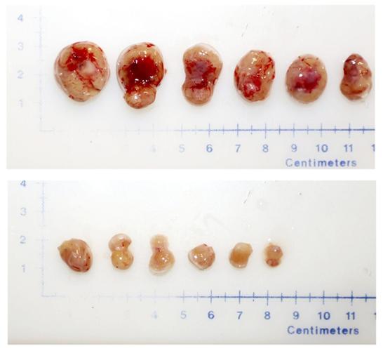 Prostate cancer treatment breakthrough could boost survival rates