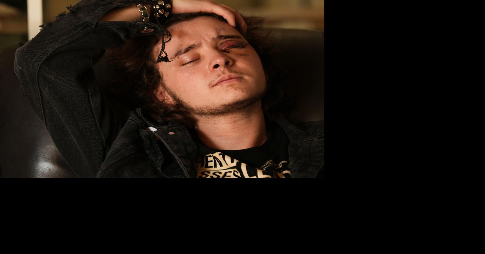 Demonstrator injured after federal agent fired projectile during California protest