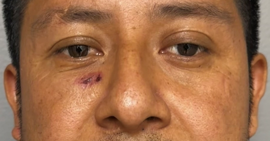 Decatur police charge man with assault after Thursday stabbing ...