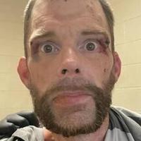 Virginia man accused of biting Morgan County corrections officer Virginia man accused of biting Morgan County corrections officer