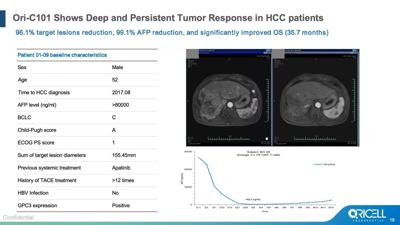 ASCO 2026 | Oricell's GPC3 CAR-T Ori-C101 Hits 66.7% ORR in Late-Line HCC, Signaling Best-in-Class Potential