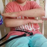 Parents report injuries to their child after school handcuff incident ...