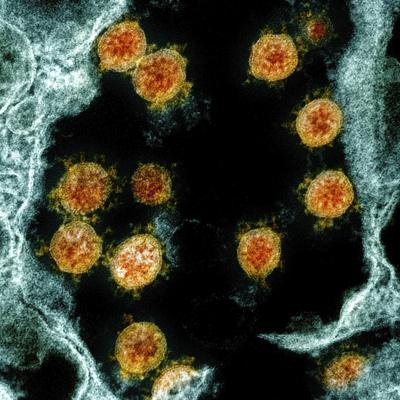 Virus Outbreak