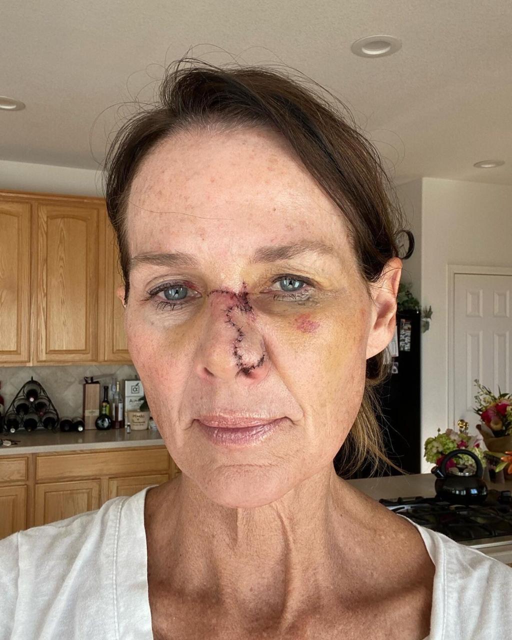 9news-meteorologist-kathy-sabine-announces-skin-cancer-procedure-denver-metro-news-denvergazette-com