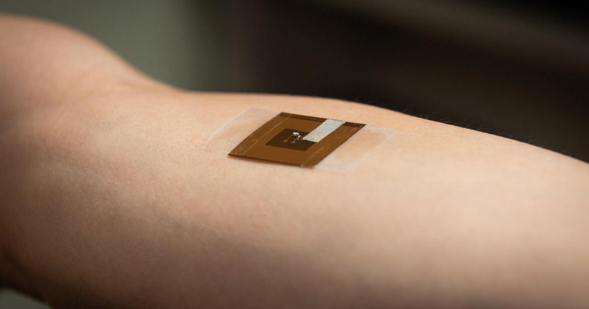 Patch can detect early signs of skin cancer | Health and Wellness Patch can detect early signs of skin cancer | Health and Wellness