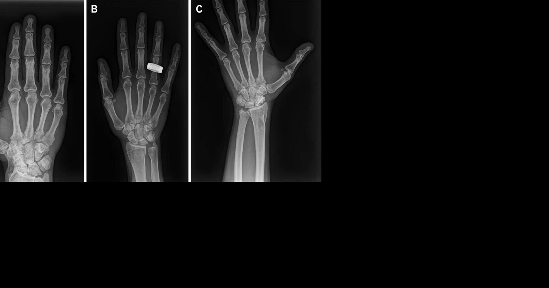 Medical X-rays taken in space for the first time