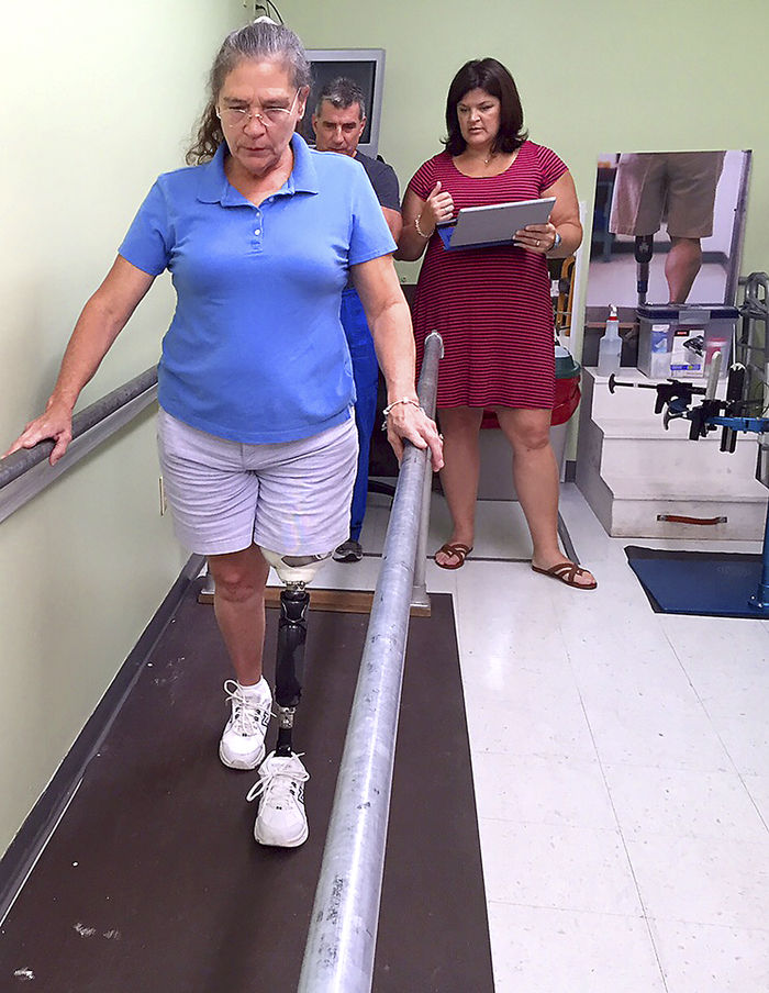 New prosthetic microprocessor knee gives Wiregrass woman new freedom ...
