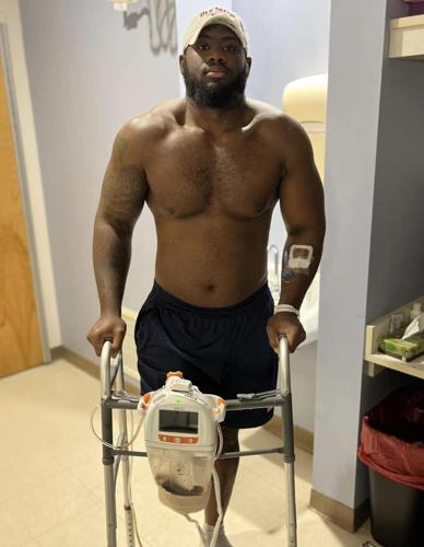 KD Hill recovers from leg amputation