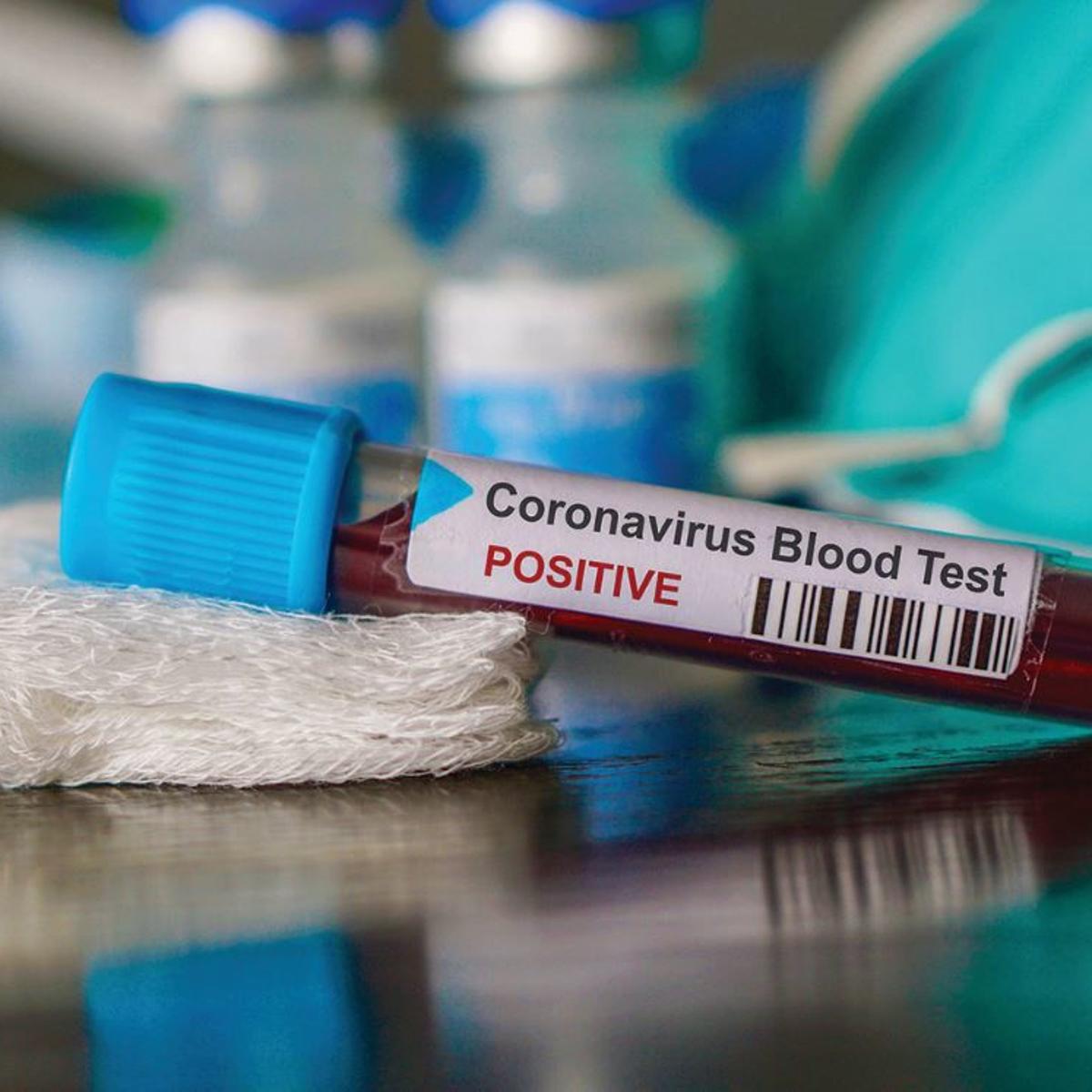 Coffee County Reports Its First Covid 19 Related Death Local News Dothaneagle Com