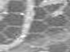 Meadows Claudia Williams Obituaries Dothaneagle Com