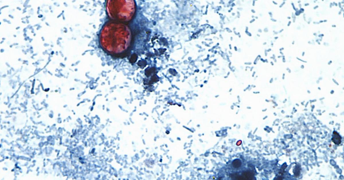 Brote de cyclospora vinculado a lechuga evidencia caída en inspecciones de la FDA