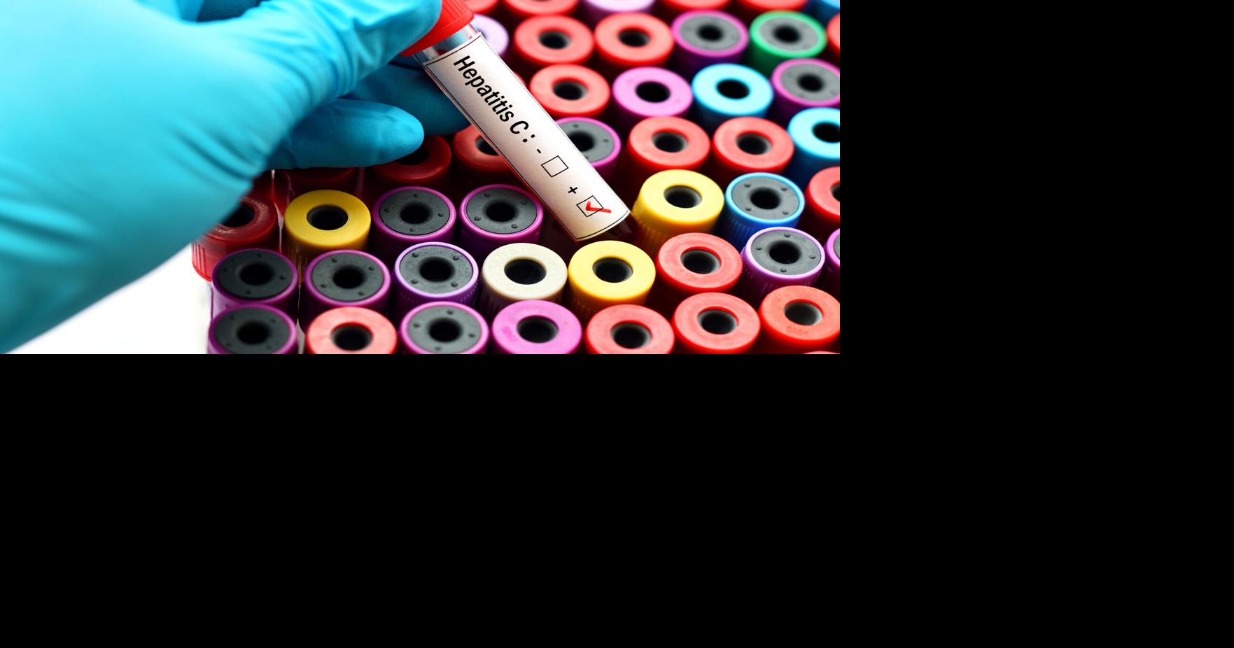 Más de 100 laboratorios ofrecerán pruebas gratuitas de hepatitis C en 42 municipios