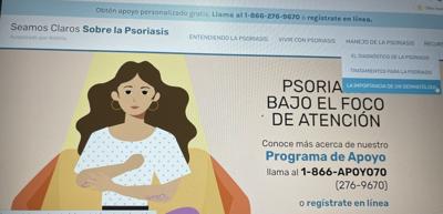Lanzan página web para explicar sobre la psoriasis
