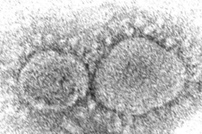 Origen del covid-19 sigue siendo un misterio