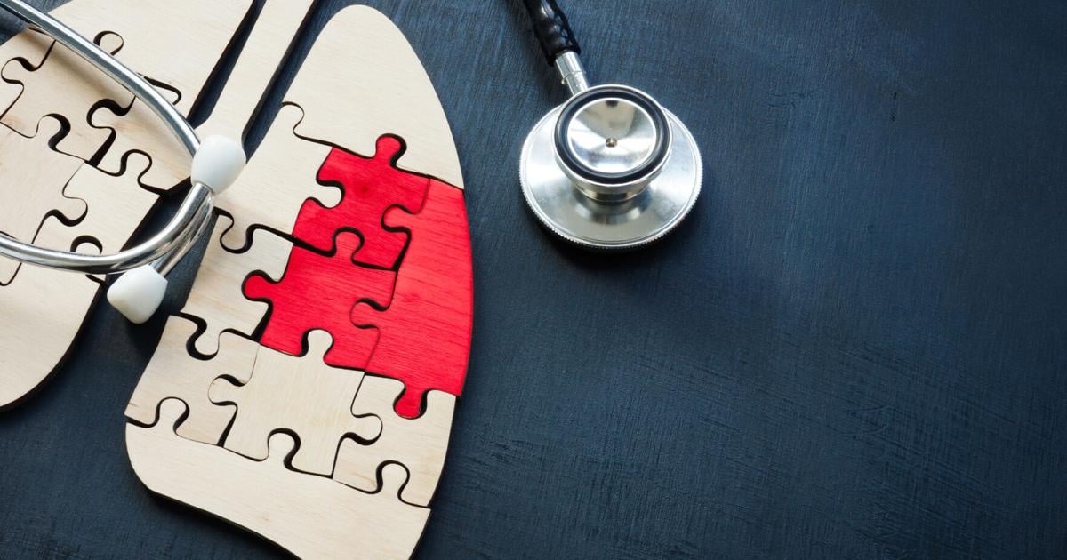 Nuevos estudios clínicos en Puerto Rico amplían opciones para pacientes con cáncer de pulmón