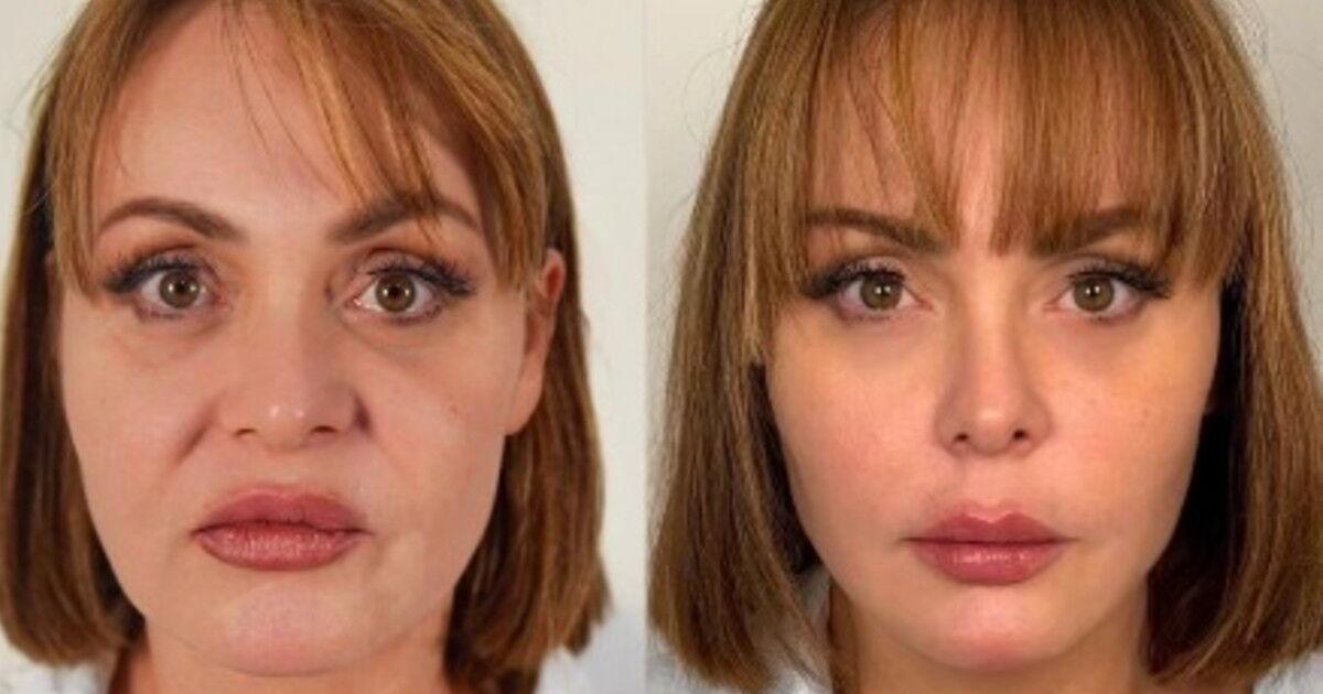 Gaby Spanic responde a críticas tras someterse a cirugía estética