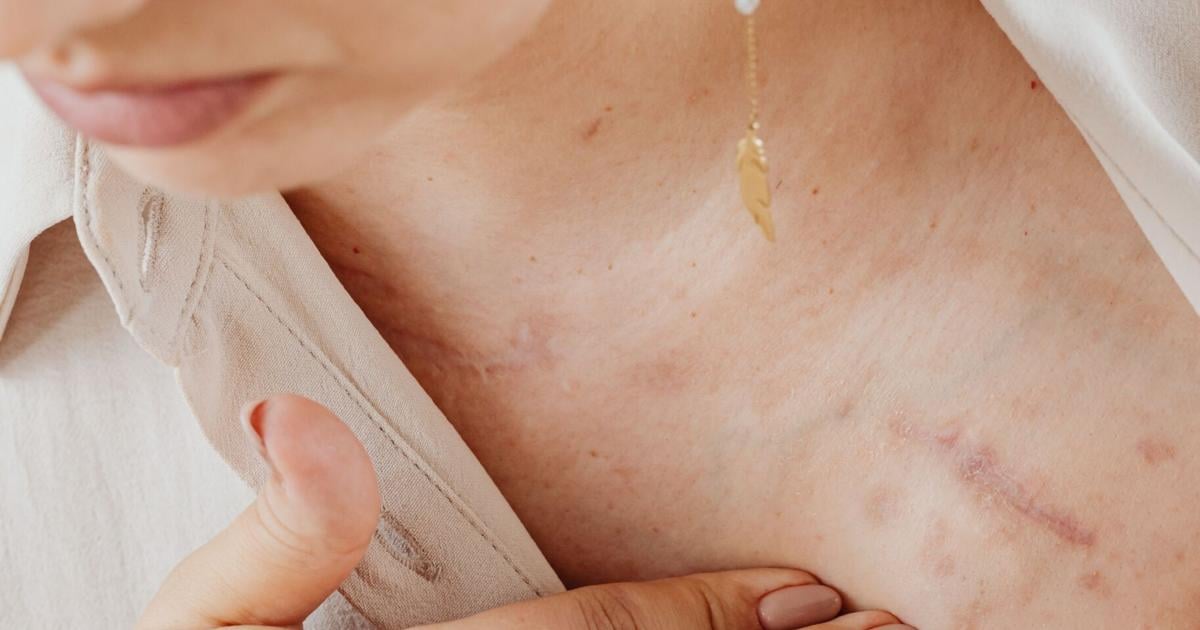 FDA aprueba aceleradamente Zenbexus, nueva terapia para el mieloma múltiple