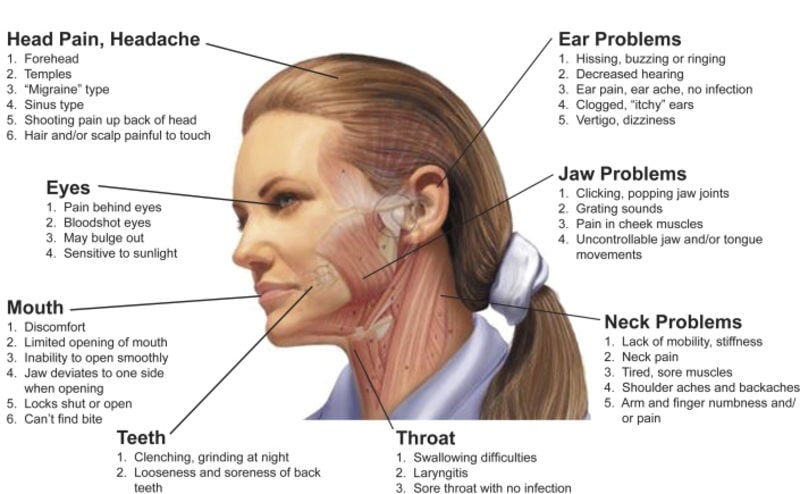 Headache Location Chart Meaning