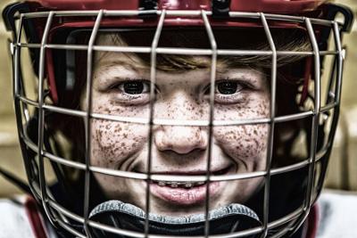 Childhood Concussions Impair Brain >> The Hard Hitting Truth About Kids Sports And Concussions Articles Childhood Concussions Impair Brain >> The Hard Hitting Truth About Kids Sports And Concussions Articles