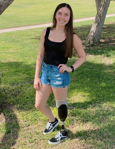 https://www.fairfieldsuntimes.com/news/national/blade-runner-despite-amputation-softball-player-perseveres-with-perspective-in-tow/article_07a0a63a-c80d-11eb-8ac3-3bfef8533268.html