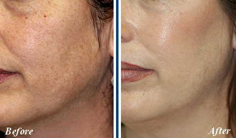 LASER HAIR REMOVAL AND MORE