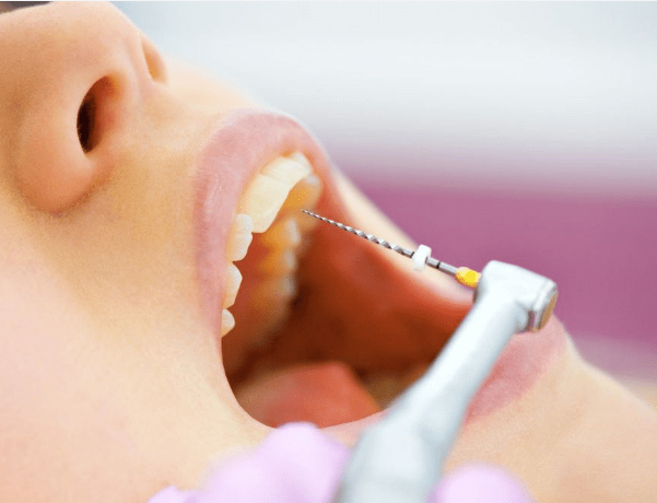 How Root Canal Treatment Can Relieve Pain and Protect Your Smile