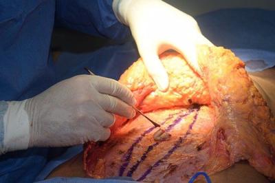 How plastic surgery can impact your life