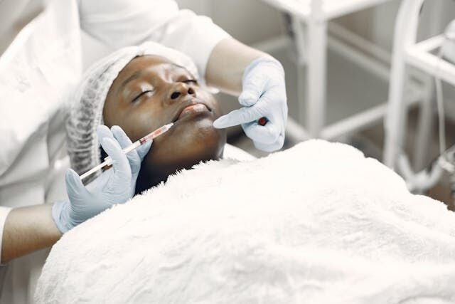 Belotero Filler For Youthful Glowing Skin