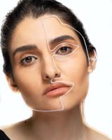 What is an Endoscopic Facelift?