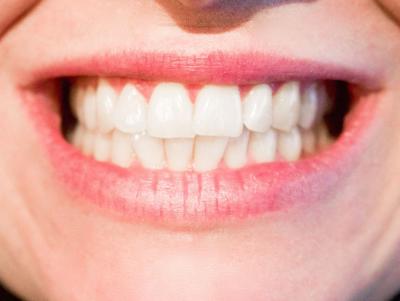 How To Get Your Smile Back: The Pros And Cons Of Dental Implants