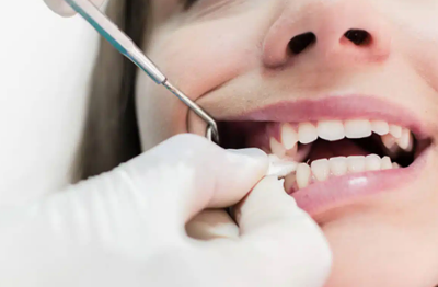 Tooth Extraction in Miami: When Removal Is Necessary