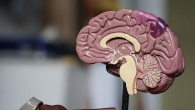Transcranial Magnetic Stimulation can be used on human brains