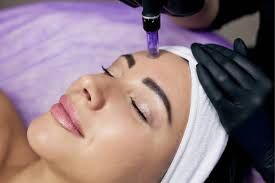 Achieving Better Microneedling Results With All-Natural Salt Facials