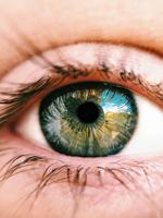 Understanding Age-Related Cataract: Causes and Treatments