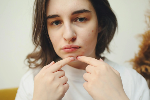 Common Mistakes Blocking Your Path to Clear Skin