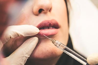Lip Fillers 101: What You Need to Know Before Enhancing Your Smile