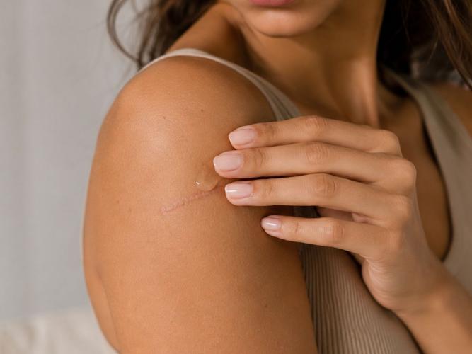 Beauty Tips: How To Avoid And Reverse Sun Damage