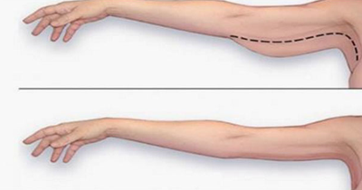 Lose Arm Fat with Exercises