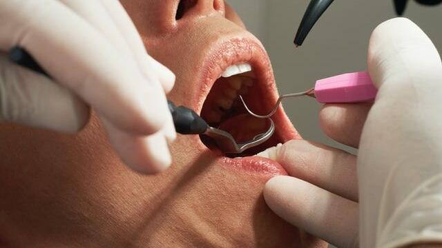 The Best And Worst Types Of Dental Fillings