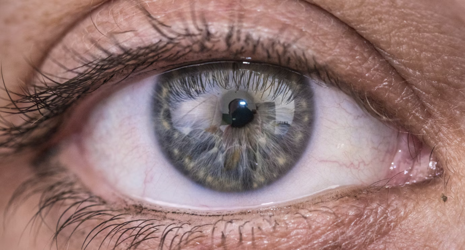 Choosing the Right Cataract Surgery Procedure
