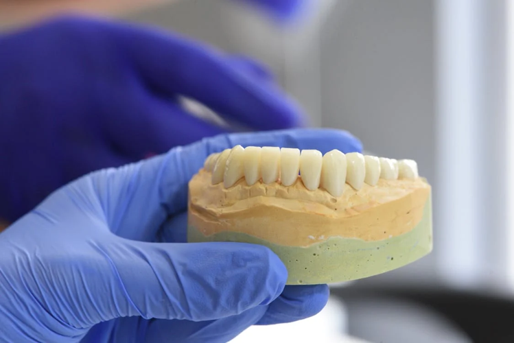 Permanent, Polished, and Practically Undetectable: The Appeal of Stonebriar Dental Implants