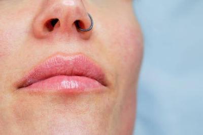 How to Choose the Right Lip Filler for Your Desired Results